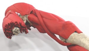 A 3D rendered image of the “bomb blast” injury